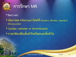 การตรวจร่างกาย MR
•Pansystolic murmur (ได้ยินเสี่ยงฟู่โดยเกิดตามหลัง S1)
•LV heaving (หัวใจห้องล่างซ้ายดันผนังหน้าอกขึ้นมาชนมือ)
•CXR พบ LA & LV hypertrophy
13/10/59POLICE NURSING COLLEGE 112
 