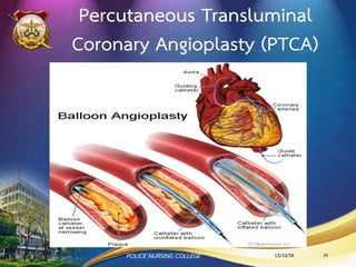 การสวนหลอดเลือดหัวใจ
(Coronary Artery Angiography : CAG)
13/10/59 24POLICE NURSING COLLEGE
 