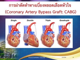 จะทา PCI หรือ CABG ดี ?
การพิจารณาทา PCI or CABG
1. ปัจจัยที่เกี่ยวข้อง ได้แก่ อายุ ความรุนแรงของอาการ
จานวนเส้นเลือดทีมีรอยตีบ LV function โรคร่วม และ
ความต้องการของผู้ป่วย เป็นต้น
2. กรณีผู้ป่วยมีเส้นเลือด LM ตีบ > 50% or 2-vessel or
3-vessel CAD with p LAD ตีบ > 70% with LVEF
<40%  CABG
3. กรณีผู้ป่วย มี 1-vessel or 2-vessel CAD  PCI
13/10/59POLICE NURSING COLLEGE 26
 