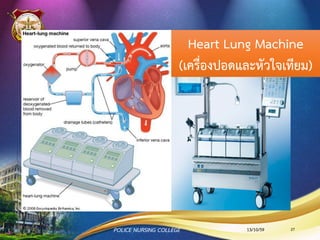 ภาวะแทรกซ้อนจากการขยายหลอดเลือดหัวใจ
1.Cardiac arrhythmias
2.ภาวะแทรกซ้อนที่อาจเกิดขึ้นขณะคาสายสวนที่ขาหนีบและภายหลังนาออก
2.1 ภาวะแทรกซ้อนที่เกิดขึ้นภายใน 24 ชั่วโมงแรก
(Early complications) เช่น
- Groin bleeding
- Retroperitoneal bleeding
- Hematoma
- Femoral neuropathy
- Vasovagal reaction
13/10/59POLICE NURSING COLLEGE 27
 