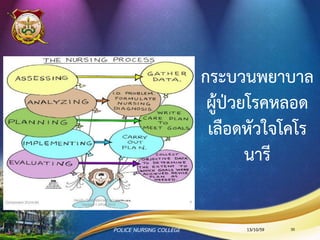 TR-BAND
Normal air injection = 13 ml.
(Max. = 18 ml.)
13/10/59POLICE NURSING COLLEGE 30
 