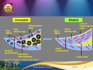 2. การประเมินความเสี่ยงในการเกิด
โรคหลอดเลือดหัวใจ
•Framingham Risk Score
ค่า Framingham 10 year Risk แบ่งระดับความ
เสี่ยงออกเป็น 3 ระดับ ดังนี้
< 10 % หมายถึง มีความเสี่ยงต่า(Low Risk)
10-20 % หมายถึง มีความเสี่ยงปานกลาง (Intermediate Risk)
> 20 % หมายถึง มีความเสี่ยงสูง (High Risk)
•Rama-EGAT score
13/10/59POLICE NURSING COLLEGE 39
 