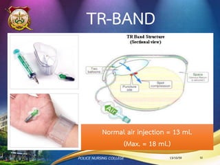 13/10/59 52POLICE NURSING COLLEGE
(สุรพันธ์ สิทธิสุข, 2557)
 