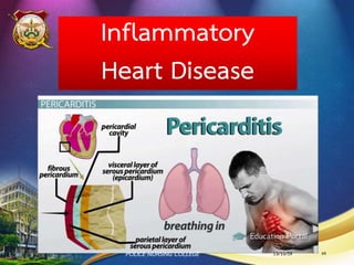 สรุปการดาเนินโรคหลอดเลือดหัวใจโคโรนารี
ภาวะหลอดเลือดโคโรนารีแข็งหรือตีบ
กล้ามเนื้อหัวใจขาดเลือด
(decrease perfusion of myocardial tissue)
เซลกล้ามเนื้อหัวใจขาดออกซิเจน
(inadequate myocardial oxygen supply)
ภาวะกล้ามเนื้อหัวใจตายเฉียบพลัน
13/10/59POLICE NURSING COLLEGE 64
 