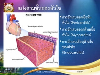 หัวใจผิดจังหวะ (Cardiac dysrhythmia)
ภาวะหัวใจล้มเหลว (Heart failure)
เสียชีวิตอย่างกะทันหัน (Sudden death)
13/10/59POLICE NURSING COLLEGE 65
สรุปการดาเนินโรคหลอดเลือดหัวใจโคโรนารี
 