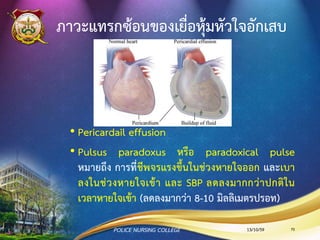 Acute Pericarditis
•ส่วนใหญ่ไม่ทราบสาเหตุ แต่ มักเกิดจาก viral infection
•การอักเสบเริ่มจากมี fibrin และน้า เกิดเฉพาะที่หรือทั่วๆไป
แล้วทาให้เยื่อหุ้มหัวใจแข็ง หนา ขาดความยืดหยุ่น ไม่
สามารถขยายตัวได้ ความจุของหัวใจลดลง ความดันรอบๆ
หัวใจสูงขึ้น มีผลให้เลือดไหลกลับเข้าหัวใจลดลง
13/10/59POLICE NURSING COLLEGE 70
 