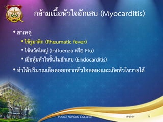 เยื่อหุ้มหัวใจอักเสบอย่างเฉียบพลัน
มีอาการสาคัญ 3 ประการ
• Precordial pain อาการเจ็บกลางอก หัวใจไหล่ทั้งสองข้าง หรือ
ที่ระหว่างกระดูกสะบักทั้งสองข้าง อาการเจ็บจะเพิ่มขึ้นเมื่อ
เคลื่อนไหวหรือนอน เมื่อนั่งก้มตัวไปข้างหน้าจะรู้สึกสบายขึ้น
• Dyspnea การหนาตัวของเยื่อหุ้มหัวใจทาให้เนื้อปอดหรือ
หลอดลมถูกกด อาการทุเทาลงโดยการลุกนั่ง นอนศีรษะสูงหรือ
นั่งก้มตัวไปข้างหน้า
• Pericardial friction rub ได้ยินชัดเจนในท่านอนหงาย นอน
ตะแคงหรือท่านั่งเอนตัวไปข้างหน้า และเมื่อหายใจเข้าและออก
เต็มที่เสียงที่ได้ยิน จะคล้ายกับการถูผมหน้าหู
13/10/59POLICE NURSING COLLEGE 72
 