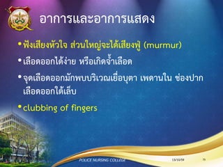 กล้ามเนื้อหัวใจอักเสบ (Myocarditis)
•สาเหตุ
• ไข้รูมาติก (Rheumatic fever)
• ไข้หวัดใหญ่ (Influenza หรือ Flu)
• เยื่อหุ้มหัวใจชั้นในอักเสบ (Endocarditis)
•ทาให้ปริมาณเลือดออกจากหัวใจลดลงและเกิดหัวใจวายได้
13/10/59POLICE NURSING COLLEGE 75
 