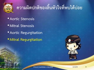 •เสี่ยงต่อปริมาณเลือดออกจากหัวใจในหนึ่งนาทีลดลง
เนื่องจากมีการอักเสบหัวใจทาให้ห้องล่างซ้ายบีบตัวลดลง
•มีอาการเจ็บหน้าอกเนื่องจากมีความไม่สมดุลระหว่าง
demand และsupply ของออกซิเจนของกล้ามเนื้อหัวใจ
•มีการแลกเปลี่ยนแก๊สลดลงเนื่องจาก pulmonary
congestion
•เสี่ยงต่อแบบแผนการหายใจไม่มีประสิทธิภาพเนื่องจาก
หลอดลมหรือปอดถูกกดทับจากกล้ามเนื้อหัวใจโต
•มีความทนในการทากิจกรรมลดลงเนื่องจากอ่อนเพลียหรือ
มีกล้ามเนื้ออ่อนแรง
ตัวอย่างข้อวินิจฉัยทางการพยาบาลใน
ผู้ป่วย Infection Heart Disease
13/10/59POLICE NURSING COLLEGE 80
 