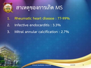 การตรวจร่างกาย AS
•Slow rising carotid pulse (pulsus tardus) &
decreased pulse amplitude (pulsus parvus)
•Heart sounds S4 gallop due to LVH.
•Systolic ejection murmur รูยิ่งตีบ เสียงยิ่งดัง
•CXR พบ Pulmonary congestion (เลือดคั่งในปอด)
13/10/59 90POLICE NURSING COLLEGE
 