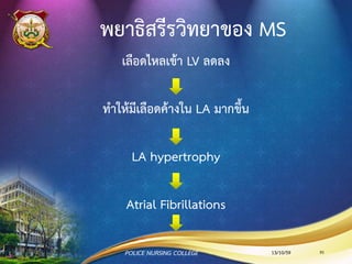 การรักษา AS
• โดยทั่วไป - รักษาเหมือนเยื่อหุ้มหัวใจอักเสบ
• การรักษาด้วยยา
- Vasodilators
- ให้ digitalis ร่วมกับการจากัดเกลือ และอาจให้ NTG
เพื่อรักษา angina pain
• Aortic Balloon Valvotomy
• Surgical Replacement
13/10/59POLICE NURSING COLLEGE 91
 