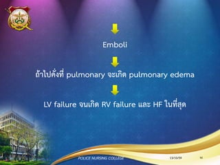 13/10/59 92POLICE NURSING COLLEGE
Mitral Stenosis
 