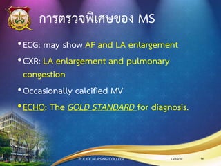 อาการและอาการแสดงของ MS
•หอบเหนื่อยและไอเป็นเลือดจากการมีเลือดคั่งที่ปอด
•อ่อนเพลีย ไม่มีแรง ใจสั่น
•กลืนอาหารลาบาก เสียงแหบ เจ็บหน้าอก หรืออาจชักหมด
สติจากหลอดเลือดที่สมองเกิดการอุดตันจาก systemic
emboli
13/10/59POLICE NURSING COLLEGE 96
 