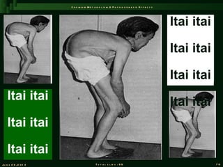 C a d m iu m M e t a b o l is m & P a t h o g e n e s is E f f e c t s




                                                                                                Itai itai

                                                                                                Itai itai

                                                                                                Itai itai
    Itai itai                                                                                   Itai itai
    Itai itai

    Itai itai
Ju n e 2 6 , 2 0 1 2                       T o t a l s l id s : 9 6                                         70
 
