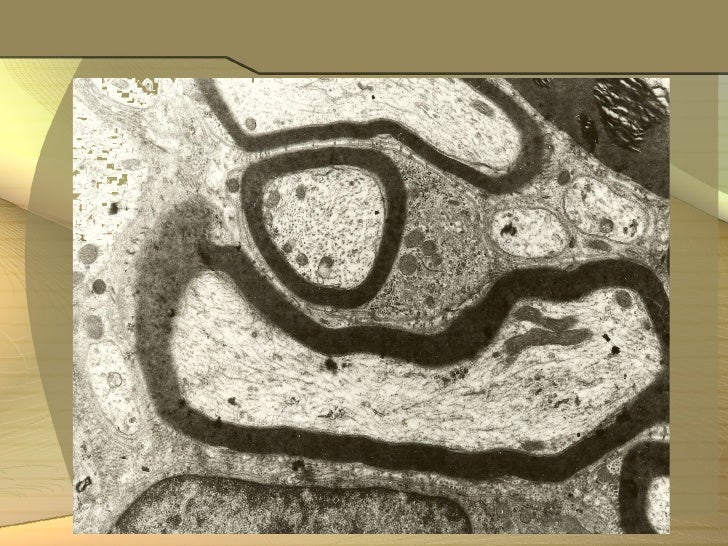 Cadmium half-life picture