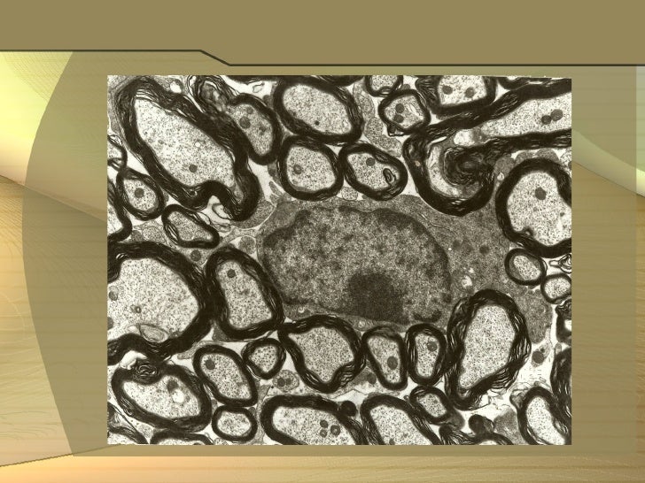 Poisoning case study image
