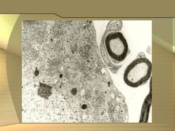 Cadmium disease image