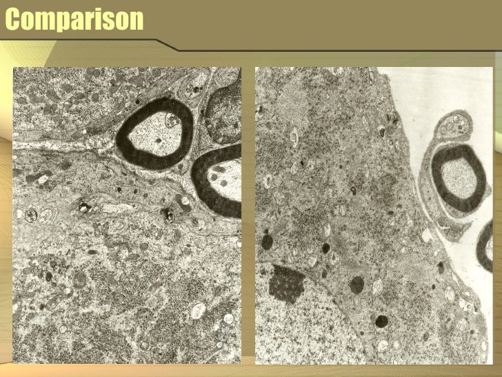 Cadmium degradation picture