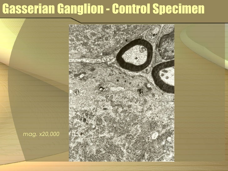 Cadmium toxicity symptoms picture