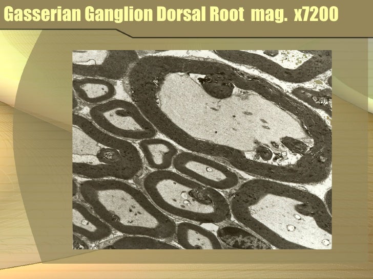 Cadmium case study image