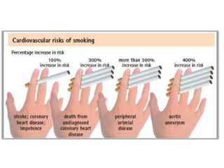 CAD -RISK FACTOR MODIFICATION AND PRIMARY PREVENTION | PPTX