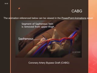 CAD Student powerpoint for nursing school | PPTX