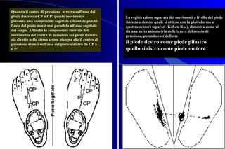 La registrazione separata dei movimenti a livello del piedeLa registrazione separata dei movimenti a livello del piede
sinistro e destro, quale si ottiene con la piattaforma asinistro e destro, quale si ottiene con la piattaforma a
quattro sensori separati (Kohen-Raz), dimostra come viquattro sensori separati (Kohen-Raz), dimostra come vi
sia una netta asimmetria delle tracce del centro disia una netta asimmetria delle tracce del centro di
pressione, potendo così definirepressione, potendo così definire
il piede destro come piede pilastroil piede destro come piede pilastro
quello sinistro come piede motorequello sinistro come piede motore
Quando il centro di pressione arretra sull'asse del
piede destro da CP a CP' questo movimento
presenta una componente sagittale e frontale poichè
l'asse del piede non è mai parallelo all'asse sagittale
del corpo. Affinchè la componente frontale del
movimento del centro di pressione sul piede sinistro
sia diretto nello stesso senso, bisogna che il centro di
pressione avanzi sull'asse del piede sinistro da CP a
CP'.
 
