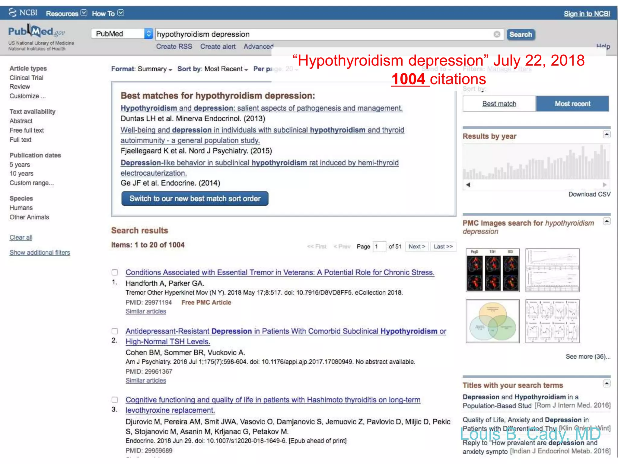 “Hypothyroidism depression” July 22, 2018
1004 citations
Louis B. Cady, MD
 