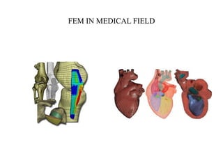 FEM IN MEDICAL FIELD
 