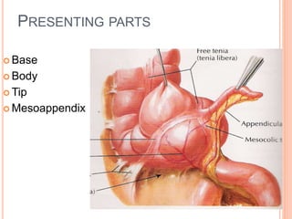 GROSS ANATOMY OF CAECUM & APPENDIX DR VKVS MBBS, MD.ppt
