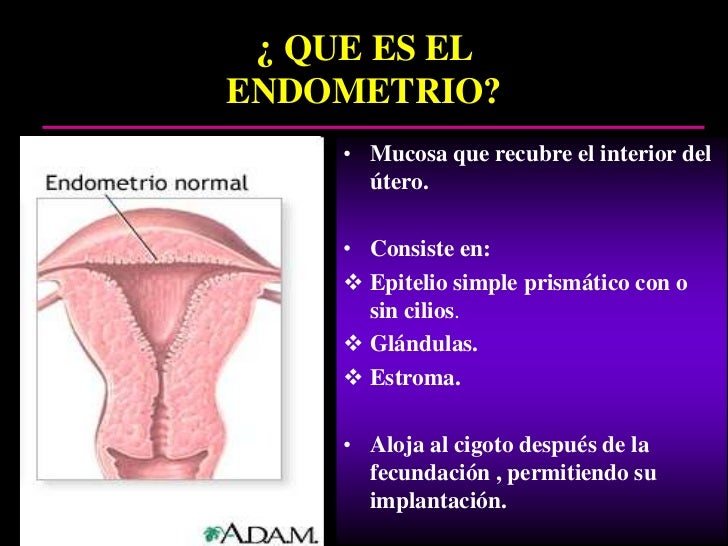 Cancer de endometrio Cancer de endometrio