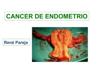 CANCER DE ENDOMETRIO
René Pareja
 