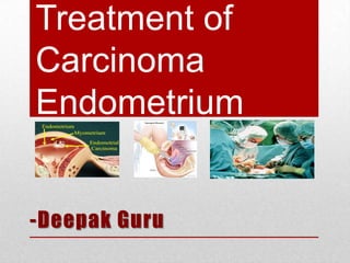 Treatment of
Carcinoma
Endometrium
-Deepak Guru

 