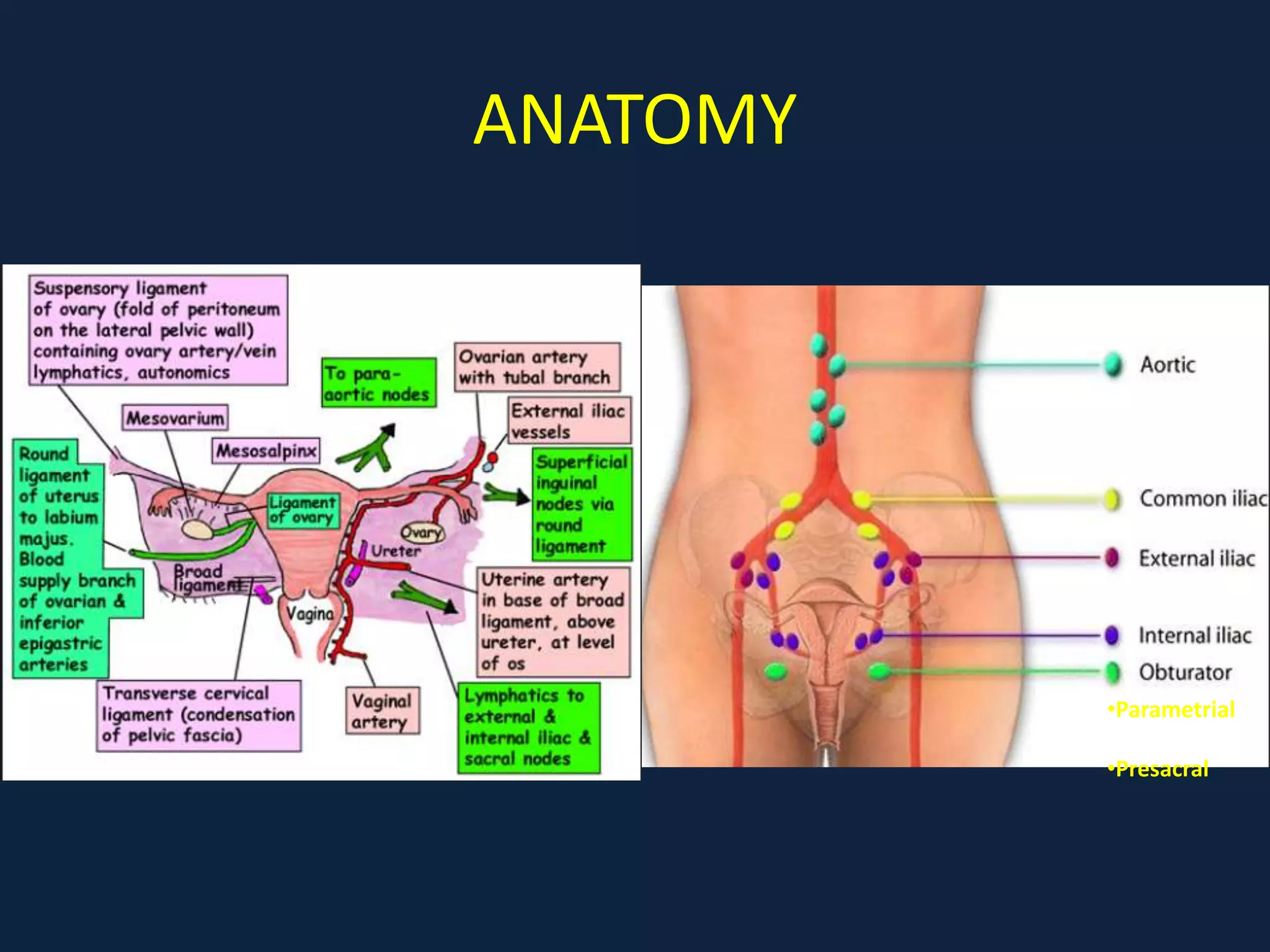 ANATOMY
•Parametrial
•Presacral
 