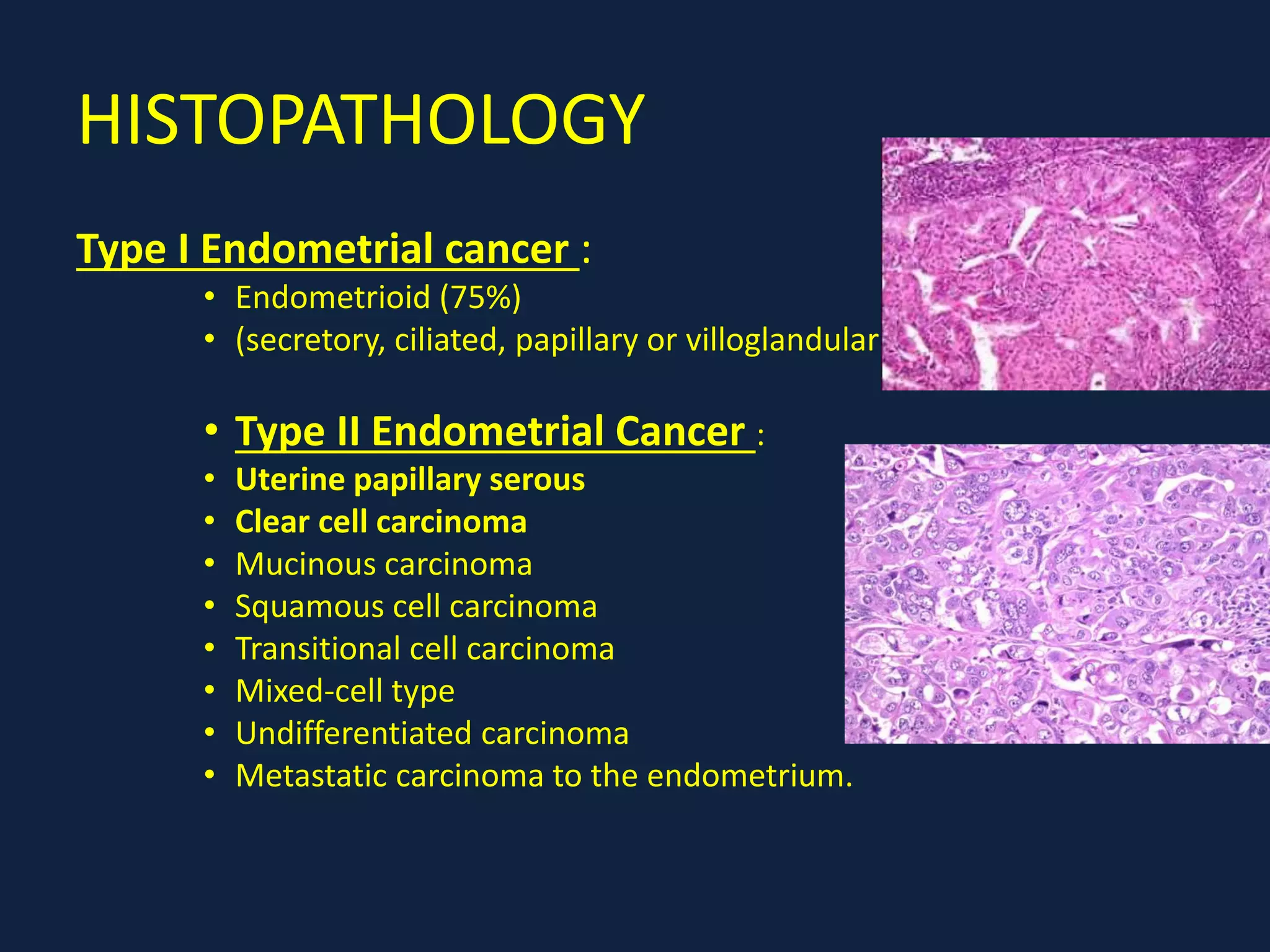 HISTOPATHOLOGY
Type I Endometrial cancer :
• Endometrioid (75%)
• (secretory, ciliated, papillary or villoglandular)
• Type II Endometrial Cancer :
• Uterine papillary serous
• Clear cell carcinoma
• Mucinous carcinoma
• Squamous cell carcinoma
• Transitional cell carcinoma
• Mixed-cell type
• Undifferentiated carcinoma
• Metastatic carcinoma to the endometrium.
 