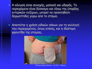 • Η κένωση είναι συνεχής, μαλακή και υδαρής. Το
περιεχόμενο είναι δύσοσμο και λόγω της ύπαρξης
εντερικών ενζύμων, μπορεί να προκληθούν
δερματίτιδες γύρω από το στόμιο.
• Απαιτείται η χρήση ειδικών σάκων για τη συλλογή
του περιεχομένου, όπως επίσης, και η ιδιαίτερη
φροντίδα της στομίας.
Παναγιωτίδης Κώστας - 4ο ΕΚ Γ' Αθήνας
 