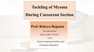 Prof. Rokeya Beguum
Prof and Advisor
Dept of OBG/ GYNAE
USTC
Director Surgiscope fertility centre
Chittagong, Bangladesh
Tackling of Myoma
During Caesarean Section
 