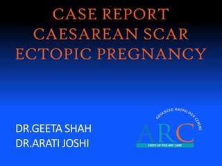 DR.GEETA SHAH
DR.ARATI JOSHI
CASE REPORT
CAESAREAN SCAR
ECTOPIC PREGNANCY
 
