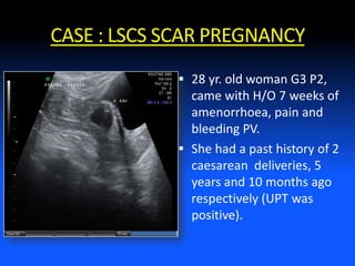 CASE : LSCS SCAR PREGNANCY
 28 yr. old woman G3 P2,
came with H/O 7 weeks of
amenorrhoea, pain and
bleeding PV.
 She had a past history of 2
caesarean deliveries, 5
years and 10 months ago
respectively (UPT was
positive).
 
