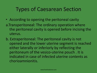 Types of Caesarean SectionAccording to opening the peritoneal cavitya.Transperitoneal: The ordinary operation where the peritoneal cavity is opened before incising the uterus.b. Extraperitoneal: The peritoneal cavity is not opened and the lower uterine segment is reached either laterally or inferiorly by reflecting the peritoneum of the vesico-uterine pouch . It is indicated in case of infected uterine contents as chorioamnionitis.www.freelivedoctor.com