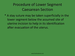 Procedure of Lower Segment Caesarean Section* A stay suture may be taken superficially in the lower segment below the assumed site of uterine incision to help in its identification after evacuation of the uterus.www.freelivedoctor.com