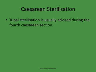 Caesarean SterilisationTubal sterilisation is usually advised during the fourth caesarean section.www.freelivedoctor.com
