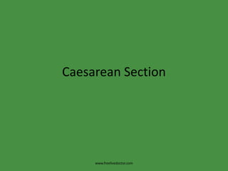 Caesarean Section www.freelivedoctor.com 