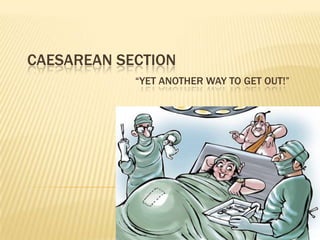CAESAREAN SECTION
            “YET ANOTHER WAY TO GET OUT!”
 