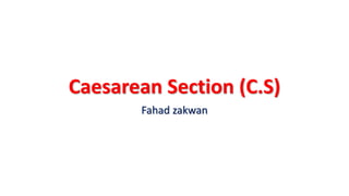 Caesarean Section (C.S)
Fahad zakwan
 