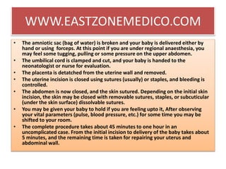 WWW.EASTZONEMEDICO.COM
• The amniotic sac (bag of water) is broken and your baby is delivered either by
hand or using forceps. At this point if you are under regional anaesthesia, you
may feel some tugging, pulling or some pressure on the upper abdomen.
• The umbilical cord is clamped and cut, and your baby is handed to the
neonatologist or nurse for evaluation.
• The placenta is detatched from the uterine wall and removed.
• The uterine incision is closed using sutures (usually) or staples, and bleeding is
controlled.
• The abdomen is now closed, and the skin sutured. Depending on the initial skin
incision, the skin may be closed with removable sutures, staples, or subcuticular
(under the skin surface) dissolvable sutures.
• You may be given your baby to hold if you are feeling upto it, After observing
your vital parameters (pulse, blood pressure, etc.) for some time you may be
shifted to your room.
• The complete procedure takes about 45 minutes to one hour in an
uncomplicated case. From the initial incision to delivery of the baby takes about
5 minutes, and the remaining time is taken for repairing your uterus and
abdominal wall.
 