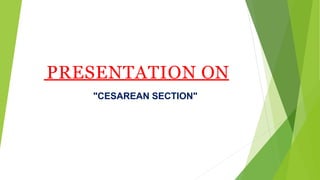 PRESENTATION ON
"CESAREAN SECTION"
 