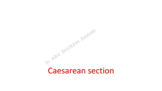 Caesarean section
 