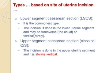 Caesareansection best | PPTX