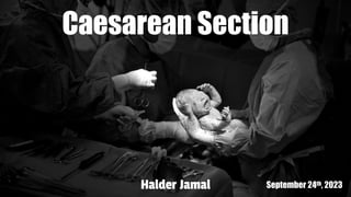 Halder Jamal September 24th, 2023
Caesarean Section
 